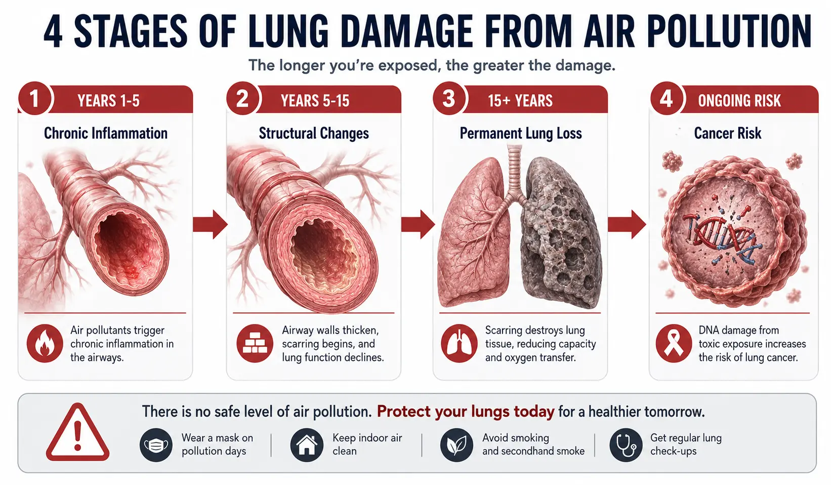 4 stages of lung damage from long-term air pollution exposure — inflammation to cancer risk timeline