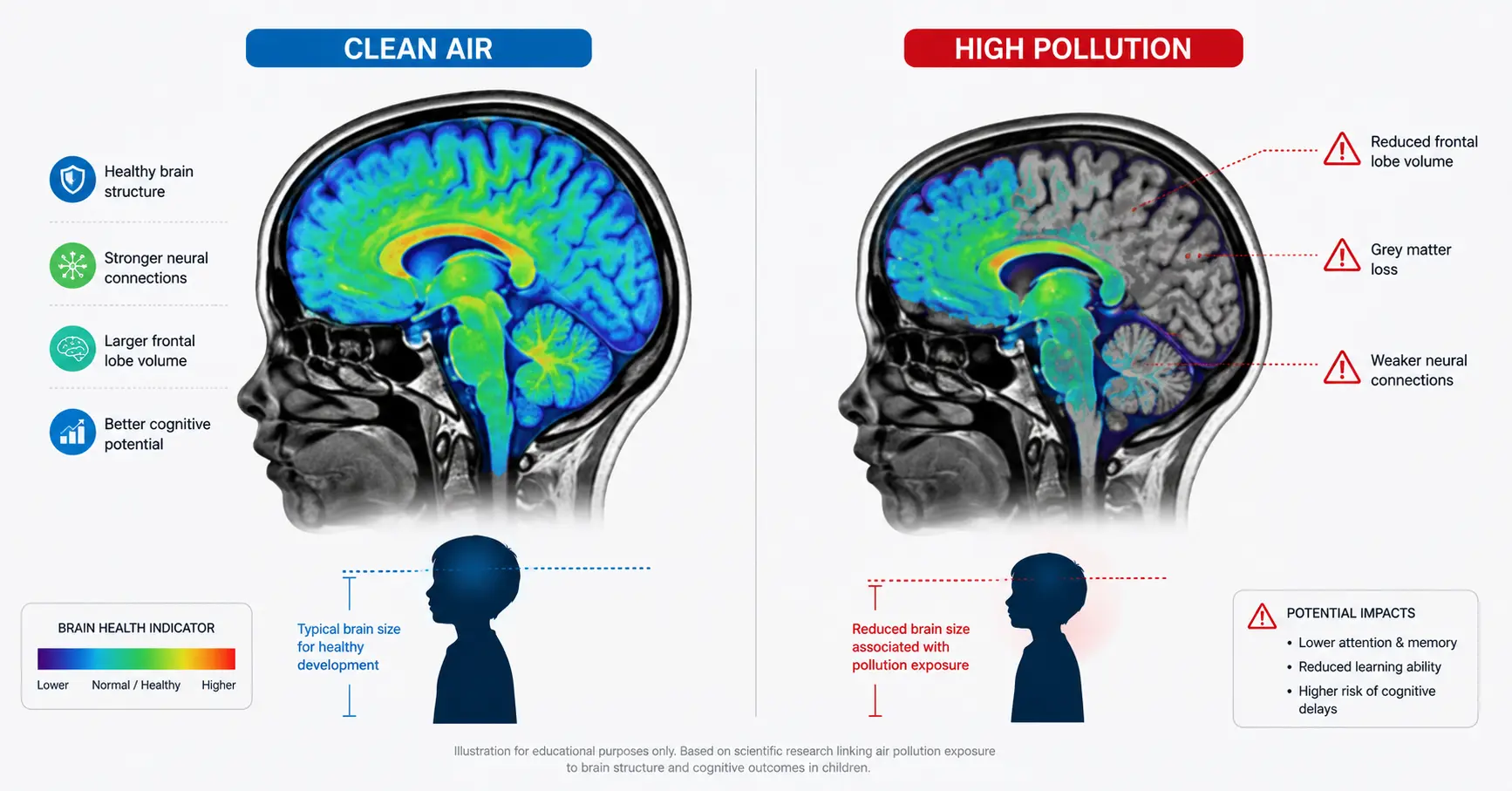 Brain scan comparison showing reduced gray matter volume in children exposed to high air pollution versus clean air environments